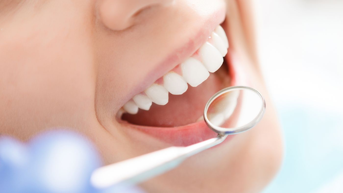 Foto de estética dental