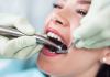 Foto de endodoncia
